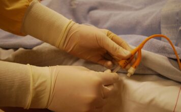 Ile kosztuje usuniecie cewnika DJ?