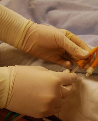 Czy lekarz rodzinny wymienia cewnik?